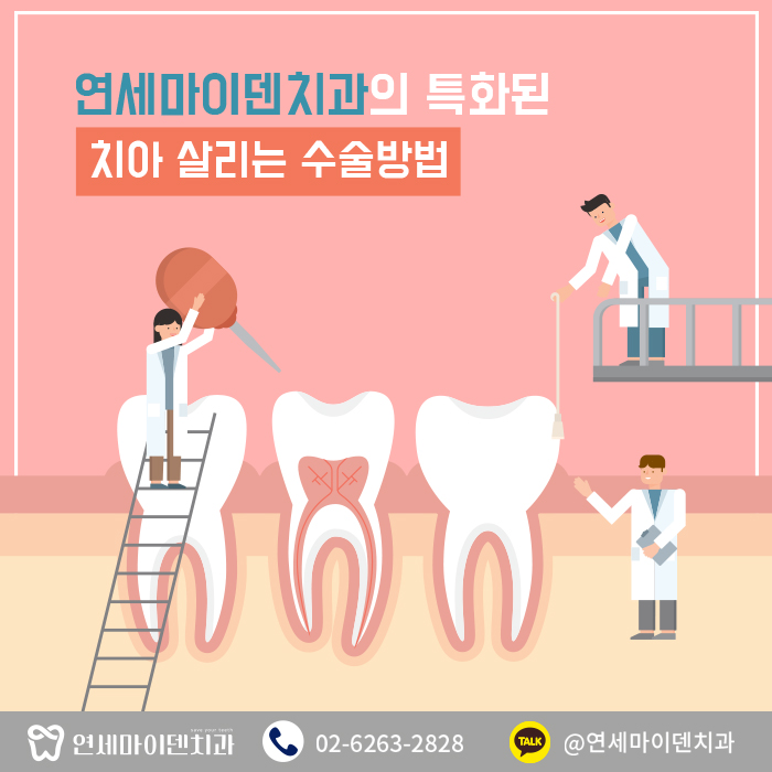 치아살리는수술방법 (1).jpg