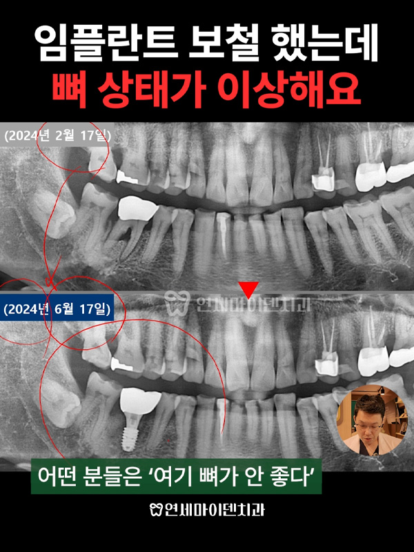 케이스252_admin_4.jpg