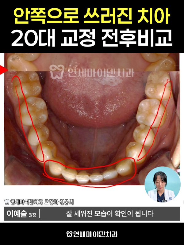 교정케이스26_admin_1.jpg