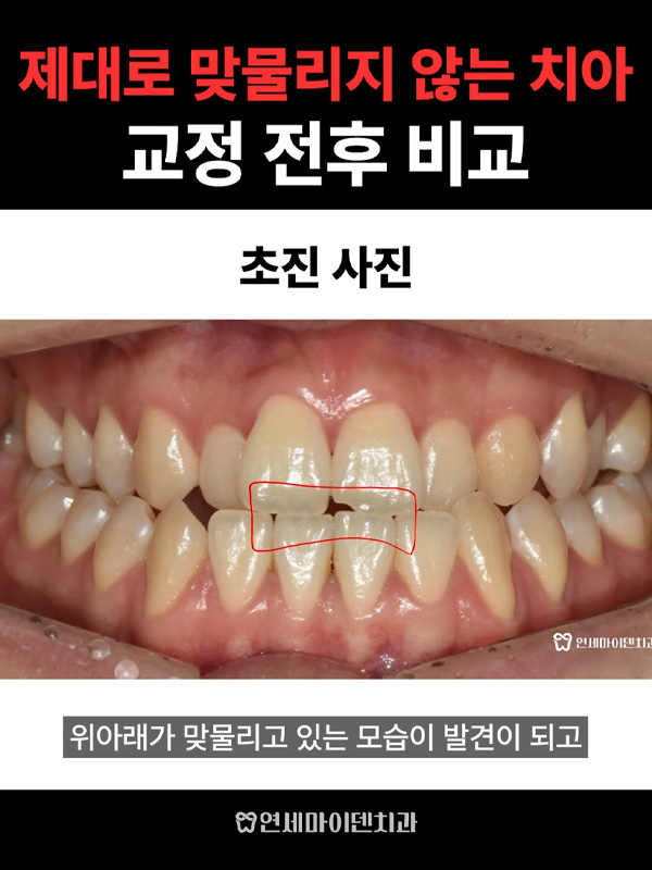 교정케이스07_admin_2.jpg
