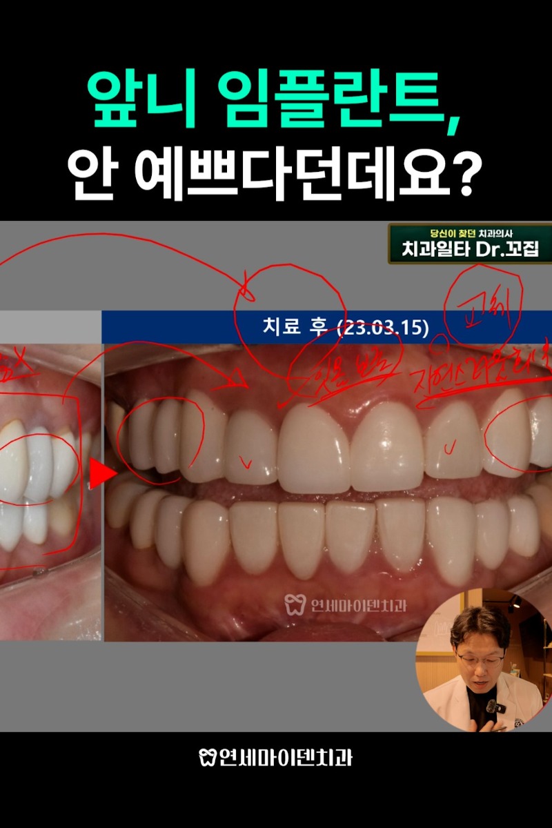 케이스301_shorts_admin (2).jpg