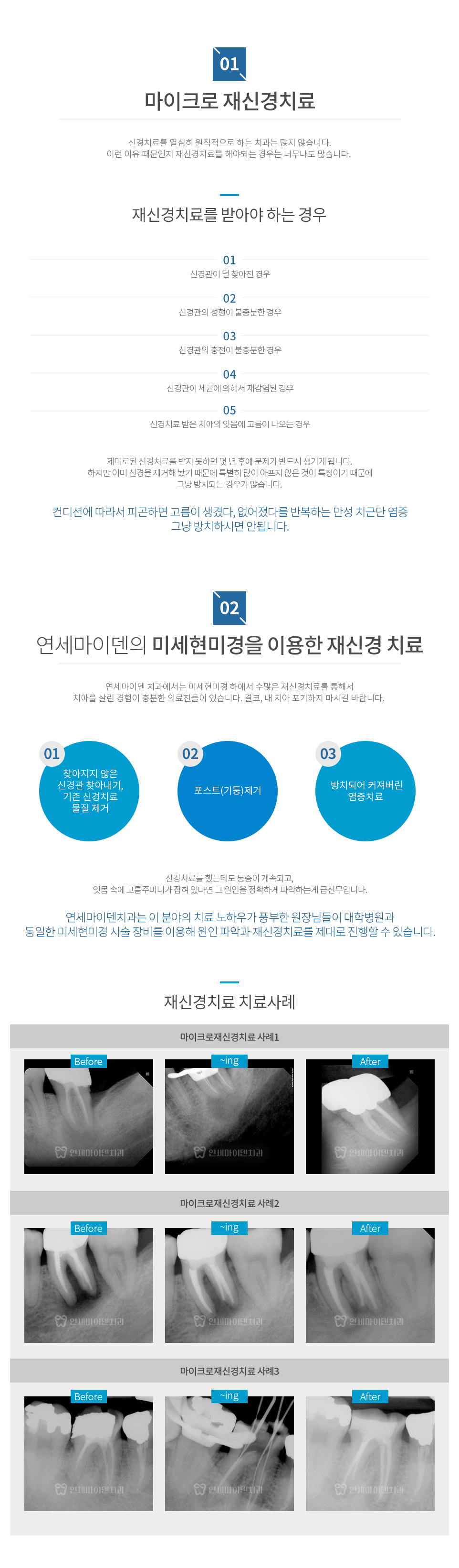 컨텐츠