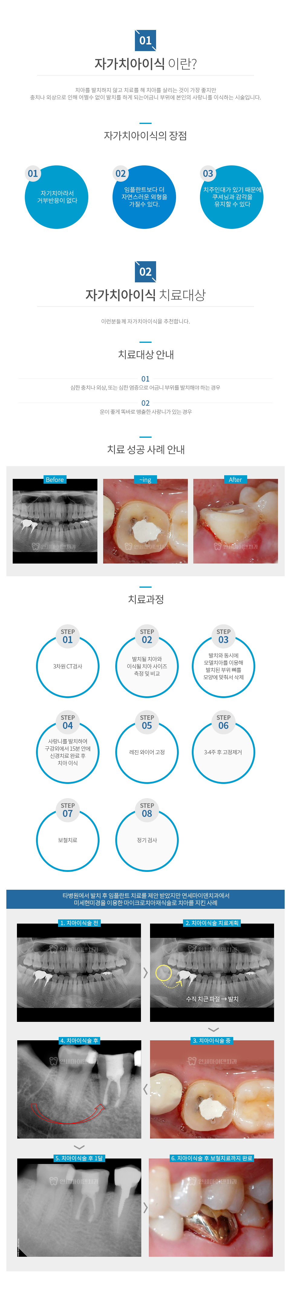 컨텐츠