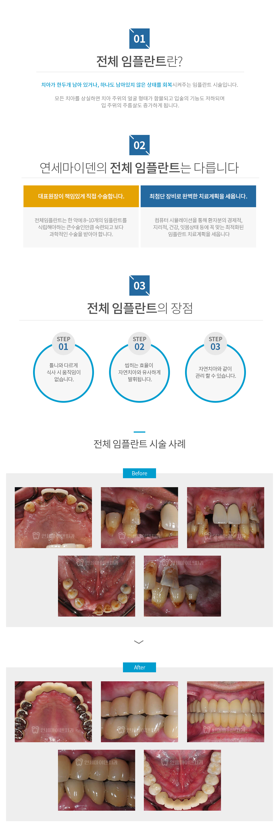 컨텐츠