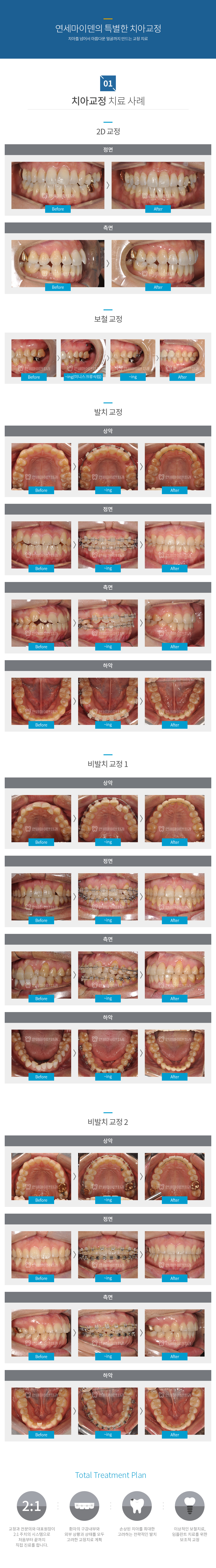 컨텐츠